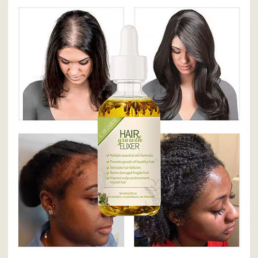 Huile Naturelle de Croissance des Cheveux